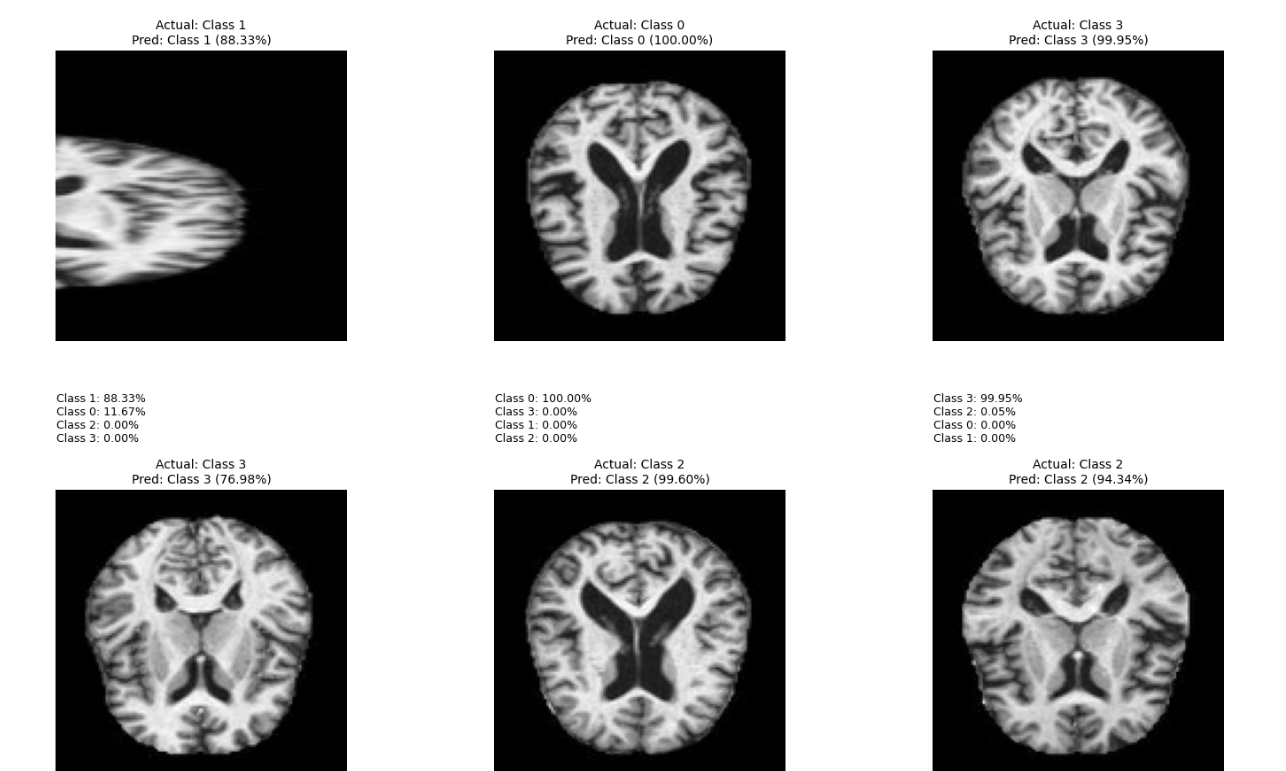 Alzheimer's Detection - Image 2