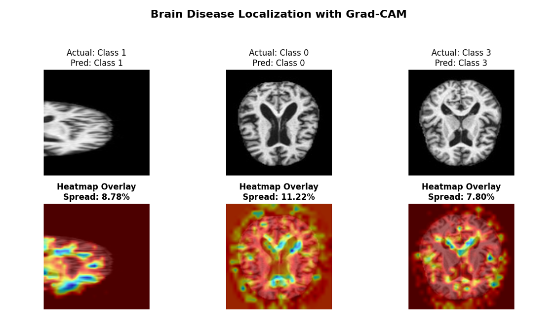 Alzheimer's Detection - Image 3