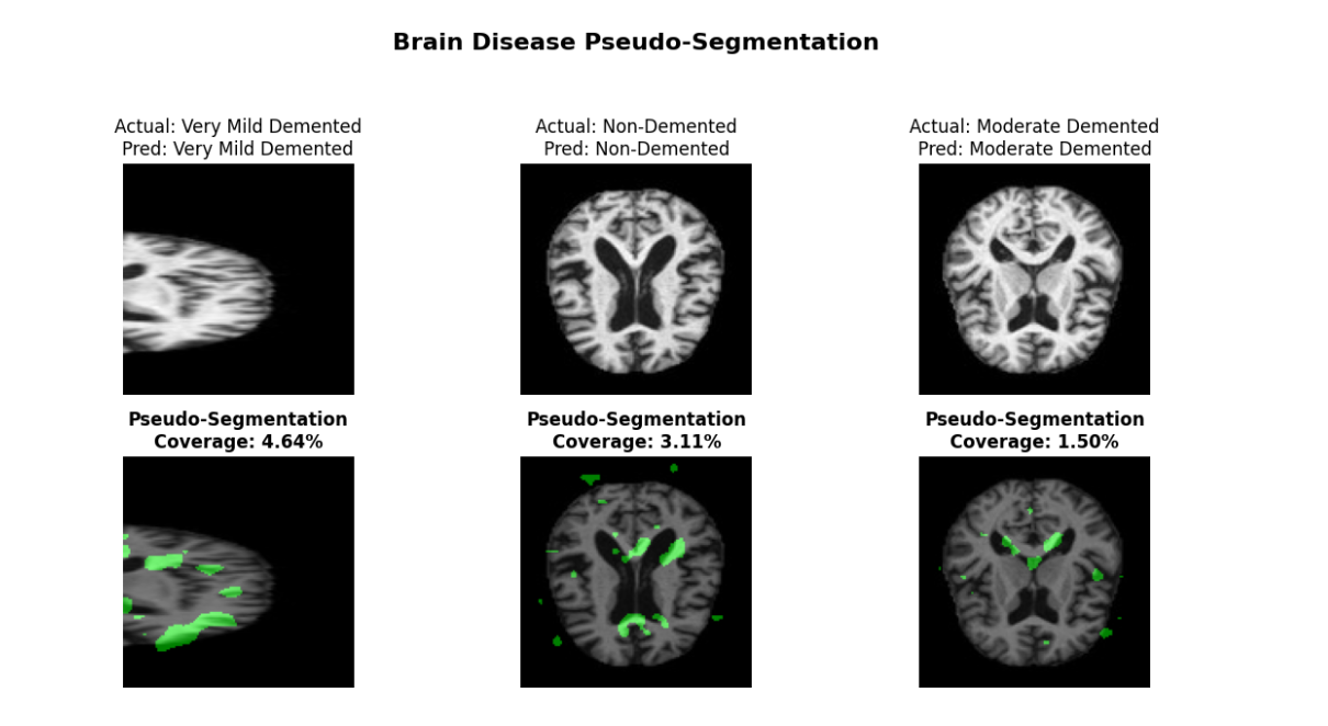 Alzheimer's Detection - Image 4